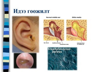 Идээ гоожилт
 