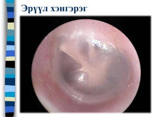 Эрүүл хэнгэрэг
 
