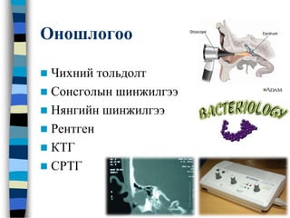 Оношлогоо
 Чихний тольдолт
 Сонсголын шинжилгээ
 Нянгийн шинжилгээ
 Рентген
 КТГ
 СРТГ
 