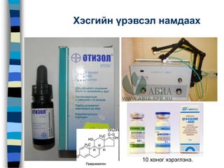 Хэсгийн үрэвсэл намдаах
10 хоног хэрэглэнэ.
 