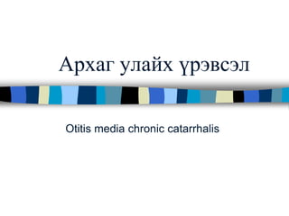 Архаг улайх үрэвсэл
Otitis media chronic catarrhalis
 