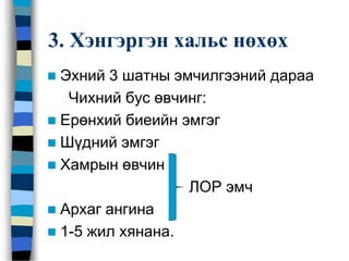 3. Хэнгэргэн хальс нөхөх
 Эхний 3 шатны эмчилгээний дараа
Чихний бус өвчинг:
 Ерөнхий биеийн эмгэг
 Шүдний эмгэг
 Хамрын өвчин
ЛОР эмч
 Архаг ангина
 1-5 жил хянана.
 