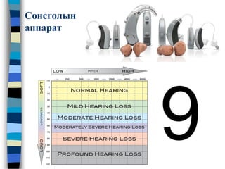 Сонсголын
аппарат
 
