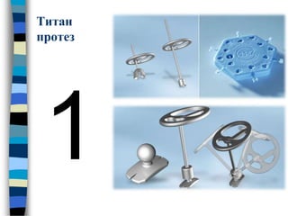 Титан
протез
 