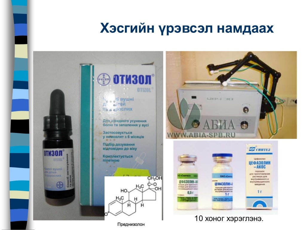Дунд чихний архаг үрэвсэл