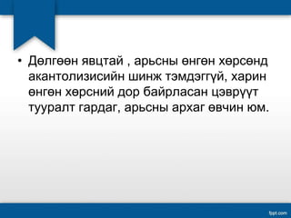 • Дөлгөөн явцтай , арьсны өнгөн хөрсөнд
акантолизисийн шинж тэмдэггүй, харин
өнгөн хөрсний дор байрласан цэврүүт
тууралт гардаг, арьсны архаг өвчин юм.
 