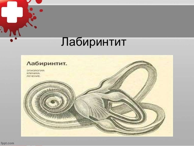 Дотор чихний эмгэг