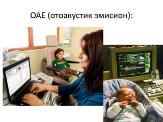 ОАЕ (отоакустик эмисион):
 