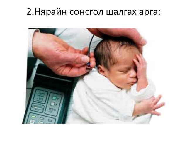 Сонсголын анализаторыг шинжлэх