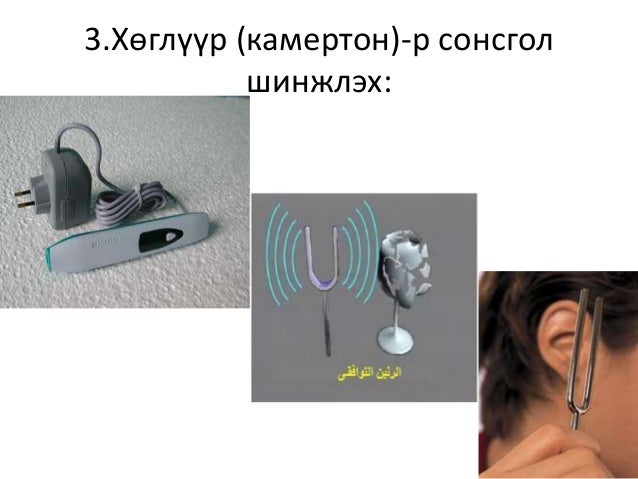 Сонсголын анализаторыг шинжлэх