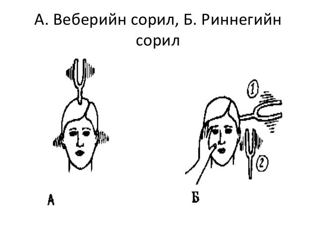 Сонсголын анализаторыг шинжлэх