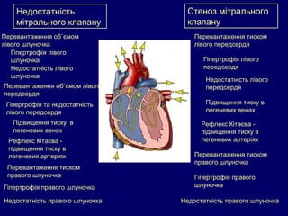 Недостатність
мітрального клапану
Перевантаження об`ємом
лівого шлуночка
Гіпертрофія лівого
шлуночка
Недостатність лівого
шлуночка
Підвищення тиску в
легеневих венах
Рефлекс Кітаєва -
підвищення тиску в
легеневих артеріях
Перевантаження тиском
правого шлуночка
Гіпертрофія правого шлуночка
Недостатність правого шлуночка
Стеноз мітрального
клапану
Перевантаження тиском
лівого передсердя
Гіпертрофія лівого
передсердя
Недостатність лівого
передсердя
Підвищення тиску в
легеневих венах
Рефлекс Кітаєва -
підвищення тиску в
легеневих артеріях
Перевантаження тиском
правого шлуночка
Гіпертрофія правого
шлуночка
Недостатність правого шлуночка
Перевантаження об`ємом лівого
передсердя
Гіпертрофія та недостатність
лівого передсердя
 