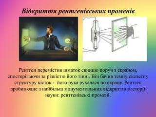 Відкриття рентгенівських променів
Рентген перемістив шматок свинцю поруч з екраном,
спостерігаючи за різкістю його тінні. Він бачив темну скелетну
структуру кісток - його рука рухалася по екрану. Рентген
зробив одне з найбільш монументальних відкриттів в історії
науки: рентгенівські промені.
 