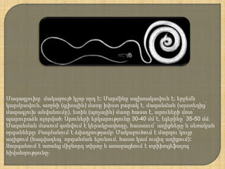 Մազագլուխը մակաբույծ կլոր որդ է։ Մարմինը սպիտակավուն է, երբեմն
կարմրավուն, առջևի (գլխային) մասը խիստ բարակ է, մազանման (այստեղից՝
մազագլուխ անվանումը), ետին (պոչային) մասը հաստ է, արուների մոտ՝
պարուրաձև ոլորված։ Արուների երկարությունը 30-40 մմ է, էգերինը՝ 35-50 մմ։
Մազանման մասում գտնվում է կերակրափողը, հաստում՝ աղիքները և սեռական
օրգանները։ Բազմանում է ձվադրությամբ։ Մակաբուծում է մարդու կույր
աղիքում (հազվադեպ՝ որդանման ելունում, հաստ կամ ուղիղ աղիքում)։
Զարգանում է առանց միջնորդ տիրոջ և առաջացնում է տրիխոցեֆալոզ
հիվանդությունը։
 