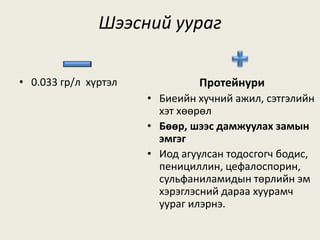 Шээсний уураг
Протейнури
• Биеийн хүчний ажил, сэтгэлийн
хэт хөөрөл
• Бөөр, шээс дамжуулах замын
эмгэг
• Иод агуулсан тодосгогч бодис,
пенициллин, цефалоспорин,
сульфаниламидын төрлийн эм
хэрэглэсний дараа хуурамч
уураг илэрнэ.
• 0.033 гр/л хүртэл
 