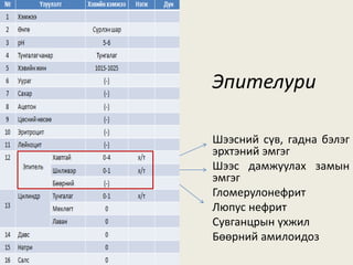 Эпителури
Шээсний сүв, гадна бэлэг
эрхтэний эмгэг
Шээс дамжуулах замын
эмгэг
Гломерулонефрит
Люпус нефрит
Сувганцрын үхжил
Бөөрний амилоидоз
 