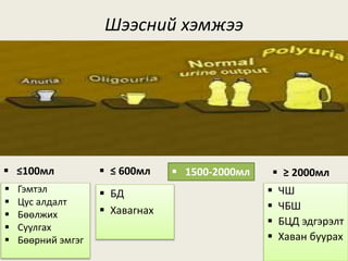 Шээсний хэмжээ
 ≤ 600мл  1500-2000мл  ≥ 2000мл
 ЧШ
 ЧБШ
 БЦД эдгэрэлт
 Хаван буурах
 ≤100мл
 Гэмтэл
 Цус алдалт
 Бөөлжих
 Суулгах
 Бөөрний эмгэг
 БД
 Хавагнах
 