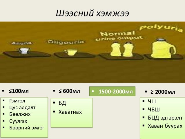 шээсний ерөнхий шинжилгээ