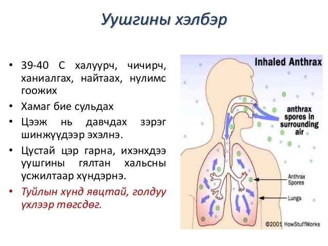 мал амьтаны гоц халдварт өвчин