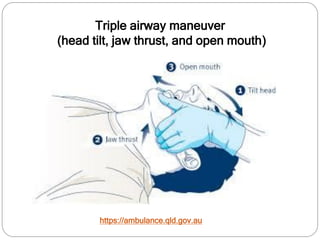 https://ambulance.qld.gov.au
Triple airway maneuver
(head tilt, jaw thrust, and open mouth)
 