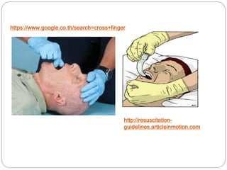 http://resuscitation-
guidelines.articleinmotion.com
https://www.google.co.th/search=cross+finger
 