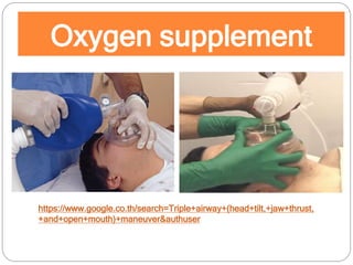 Oxygen supplement
https://www.google.co.th/search=Triple+airway+(head+tilt,+jaw+thrust,
+and+open+mouth)+maneuver&authuser
 