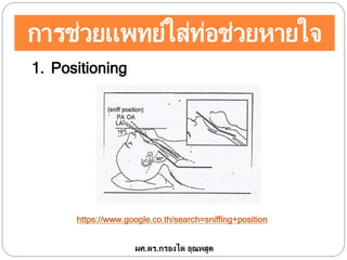 การช่วยแพทย์ใส่ท่อช่วยหายใจ
1. Positioning
ผศ.ดร.กรองได อุณหสูต
https://www.google.co.th/search=sniffing+position
 