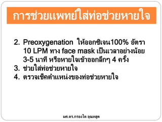 การช่วยแพทย์ใส่ท่อช่วยหายใจ
ผศ.ดร.กรองได อุณหสูต
2. Preoxygenation ให้ออกซิเจน100% อัตรา
10 LPM ทาง face mask เป็นเวลาอย่างน้อย
3-5 นาที หรือหายใจเข้าออกลึกๆ 4 ครั้ง
3. ช่วยใส่ท่อช่วยหายใจ
4. ตรวจเช็คตาแหน่งของท่อช่วยหายใจ
 