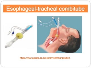 Esophageal-tracheal combitube
https://www.google.co.th/search=sniffing+position
 