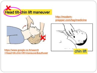 https://www.google.co.th/search
=Head+tilt-chin+lift+maneuver&authuser
http://modern-
prepper.com/tag/medicine
chin lift
Head tilt-chin lift maneuver

 