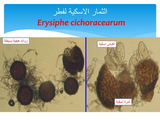 ‫الثمار‬‫االسكية‬‫لفطر‬
Erysiphe cichoracearum
‫زوائد‬‫هيفية‬‫بسيطة‬
‫اكياس‬‫اسكية‬
‫ثمرة‬‫اسكية‬
 