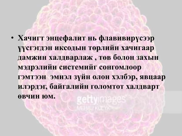 хачигт энцефалит