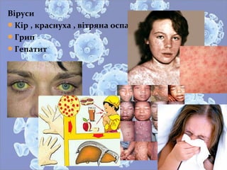 Віруси
Кір , краснуха , вітряна оспа.
Грип
Гепатит
 