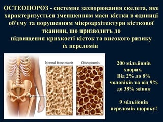 ОСТЕОПОРОЗ - системне захворювання скелета, яке
характеризується зменшенням маси кістки в одиниці
об'єму та порушенням мікроархітектури кісткової
тканини, що призводить до
підвищення крихкості кісток та високого ризику
їх переломів
200 мільйонів
хворих.
Від 2% до 8%
чоловіків та від 9%
до 38% жінок
9 мільйонів
переломів щороку!
 