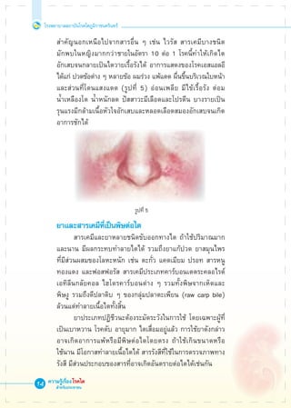 โรงพยาบาลสถาบันโรคไตภูมิราชนครินทร์
ความรู้เรื่องโรคไต
สำหรับประชาชน
14
	 สำคัญนอกเหนือไปจากสารอื่น ๆ เช่น ไวรัส สารเคมีบางชนิด 

	 มักพบในหญิงมากกว่าชายในอัตรา 10 ต่อ 1 โรคนี้ทำให้เกิดไต

	 อักเสบจนกลายเป็นไตวายเรื้อรังได้ อาการแสดงของโรคเอสแอลอี 

	 ได้แก่ ปวดข้อต่าง ๆ หลายข้อ ผมร่วง แพ้แดด ผื่นขึ้นบริเวณใบหน้า 

	 และส่วนที่โดนแสงแดด (รูปที่ 5) อ่อนเพลีย มีไข้เรื้อรัง ต่อม

	 น้ำเหลืองโต น้ำหนักลด ปัสสาวะมีเลือดและโปรตีน บางรายเป็น

	 รุนแรงมีกล้ามเนื้อหัวใจอักเสบและหลอดเลือดสมองอักเสบจนเกิด

	 อาการชักได้








	 ยาและสารเคมีที่เป็นพิษต่อไต
			 สารเคมีและยาหลายชนิดขับออกทางไต ถ้าใช้ปริมาณมาก

	 และนาน มีผลกระทบทำลายไตได้ รวมถึงยาแก้ปวด ยาสมุนไพร

	 ที่มีส่วนผสมของโลหะหนัก เช่น ตะกั่ว แคดเมียม ปรอท สารหนู 

	 ทองแดง และฟอสฟอรัส สารเคมีประเภทคาร์บอนเตตระคลอไรด์ 

	 เอทิลีนกลัยคอล ไฮโดรคาร์บอนต่าง ๆ รวมทั้งพิษจากเห็ดและ

	 พิษงู รวมถึงดีปลาดิบ ๆ ของกลุ่มปลาตะเพียน (raw carp bile) 

	 ล้วนแต่ทำลายเนื้อไตทั้งสิ้น 	 
			 ยาประเภทปฏิชีวนะต้องระมัดระวังในการใช้ โดยเฉพาะผู้ที่

	 เป็นเบาหวาน โรคตับ อายุมาก ไตเสื่อมอยู่แล้ว การใช้ยาดังกล่าว

	 อาจเกิดอาการแพ้หรือมีพิษต่อไตโดยตรง ถ้าใช้เกินขนาดหรือ

	 ใช้นาน มีโอกาสทำลายเนื้อไตได้ สารรังสีที่ใช้ในการตรวจภาพทาง

	 รังสี มีส่วนประกอบของสารที่อาจเกิดอันตรายต่อไตได้เช่นกัน
 