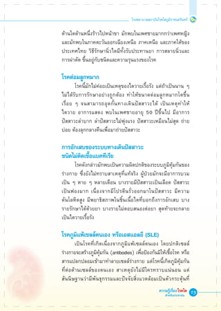 13
โรงพยาบาลสถาบันโรคไตภูมิราชนครินทร์
ความรู้เรื่องโรคไต
สำหรับประชาชน
	 ด้านใดด้านหนึ่งร้าวไปหน้าขา มักพบในเพศชายมากกว่าเพศหญิง 

	 และมักพบในภาคตะวันออกเฉียงเหนือ ภาคเหนือ และภาคใต้ของ

	 ประเทศไทย วิธีรักษานิ่วไตมีทั้งรับประทานยา การสลายนิ่วและ

	 การผ่าตัด ขึ้นอยู่กับชนิดและความรุนแรงของโรค

	 โรคต่อมลูกหมาก
			 โรคนี้มักไม่ค่อยเป็นเหตุของไตวายเรื้อรัง แต่ถ้าเป็นนาน ๆ 

	 ไม่ได้รับการรักษาอย่างถูกต้อง ทำให้ขนาดต่อมลูกหมากโตขึ้น

	 เรื่อย ๆ จนสามารถอุดกั้นทางเดินปัสสาวะได้ เป็นเหตุทำให้

	 ไตวาย อาการแสดง พบในเพศชายอายุ 50 ปีขึ้นไป มีอาการ

	 ปัสสาวะลำบาก ลำปัสสาวะไม่พุ่งแรง ปัสสาวะเหมือนไม่สุด ถ่าย

	 บ่อย ต้องลุกกลางคืนเพื่อมาถ่ายปัสสาวะ

	 การอักเสบของระบบทางเดินปัสสาวะ
	 ชนิดไม่ติดเชื้อแบคทีเรีย
			 โรคดังกล่าวมักพบเป็นความผิดปกติของระบบภูมิคุ้มกันของ

	 ร่างกาย ซึ่งยังไม่ทราบสาเหตุที่แท้จริง ผู้ป่วยมักจะมีอาการบวม

	 เป็น ๆ หาย ๆ หลายเดือน บางรายมีปัสสาวะเป็นเลือด ปัสสาวะ

	 เป็นฟองมาก เนื่องจากมีโปรตีนรั่วออกมาในปัสสาวะ มีความ

	 ดันโลหิตสูง มีพยาธิสภาพในชิ้นเนื้อไตที่บอกถึงการอักเสบ บาง

	 รายรักษาได้ด้วยยา บางรายไม่ตอบสนองต่อยา สุดท้ายจะกลาย

	 เป็นไตวายเรื้อรัง

	 โรคภูมิแพ้เซลล์ตนเอง หรือเอสแอลอี (SLE)
			 เป็นโรคที่เกิดเนื่องจากภูมิแพ้เซลล์ตนเอง โดยปกติเซลล์

	 ร่างกายจะสร้างภูมิคุ้มกัน (antibodies) เพื่อป้องกันมิให้เชื้อโรค หรือ 

	 สารแปลกปลอมเข้ามาทำลายเซลล์ร่างกาย แต่โรคนี้เกิดภูมิคุ้มกัน 

	 ที่ต่อต้านเซลล์ของตนเอง สาเหตุยังไม่มีใครทราบแน่นอน แต่

	 สันนิษฐานว่ามีพันธุกรรมและปัจจัยสิ่งแวดล้อมเป็นตัวกระตุ้นที่

 