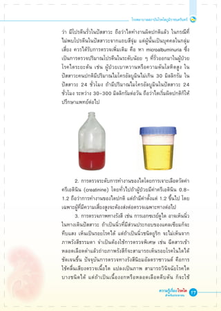 17
โรงพยาบาลสถาบันโรคไตภูมิราชนครินทร์
ความรู้เรื่องโรคไต
สำหรับประชาชน
	 ว่า มีโปรตีนรั่วในปัสสาวะ ถือว่าไตทำงานผิดปกติแล้ว ในกรณีที่

	 ไม่พบโปรตีนในปัสสาวะจากแถบสีจุ่ม แต่ผู้นั้นเป็นบุคคลในกลุ่ม

	 เสี่ยง ควรได้รับการตรวจเพิ่มเติม คือ หา microalbuminuria ซึ่ง

	 เป็นการตรวจปริมาณโปรตีนในระดับน้อย ๆ ที่รั่วออกมาในผู้ป่วย

	 โรคไตระยะต้น เช่น ผู้ป่วยเบาหวานหรือความดันโลหิตสูง ใน

	 ปัสสาวะคนปกติมีปริมาณไมโครอัลบูมินไม่เกิน 30 มิลลิกรัม ใน

	 ปัสสาวะ 24 ชั่วโมง ถ้ามีปริมาณไมโครอัลบูมินในปัสสาวะ 24 

	 ชั่วโมง ระหว่าง 30-300 มิลลิกรัมต่อวัน ถือว่าไตเริ่มผิดปกติก็ให้

	 ปรึกษาแพทย์ต่อไป








			 2.	การตรวจระดับการทำงานของไตโดยการเจาะเลือดวัดค่า 

	 ครีเอตินิน (creatinine) โดยทั่วไปถ้าผู้ป่วยมีค่าครีเอตินิน 0.8-

	 1.2 ถือว่าการทำงานของไตปกติ แต่ถ้ามีค่าตั้งแต่ 1.2 ขึ้นไป โดย

	 เฉพาะผู้ที่มีความเสี่ยงสูงจะต้องส่งต่อตรวจเฉพาะทางต่อไป
			 3.	การตรวจภาพทางรังสี เช่น การเอกซเรย์ดูไต อาจเห็นนิ่ว

	 ในทางเดินปัสสาวะ ถ้าเป็นนิ่วที่มีส่วนประกอบของแคลเซียมก็จะ

	 ทึบแสง เห็นเป็นรอยโรคได้ แต่ถ้าเป็นนิ่วชนิดยูริก จะไม่เห็นจาก

	 ภาพรังสีธรรมดา จำเป็นต้องใช้การตรวจพิเศษ เช่น ฉีดสารเข้า

	 หลอดเลือดดำแล้วถ่ายภาพรังสีก็จะสามารถเห็นรอยโรคในไตได้

	 ชัดเจนขึ้น ปัจจุบันการตรวจทางรังสีนิยมอัลตราซาวนด์ คือการ

	 ใช้คลื่นเสียงตรวจเนื้อไต แปลงเป็นภาพ สามารถวินิจฉัยโรคไต

	 บางชนิดได้ แต่ถ้าเป็นเนื้องอกหรือหลอดเลือดตีบตัน ก็จะใช้

 