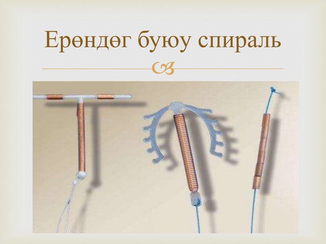 Жирэмслэлтээс хамгаалах аргууд