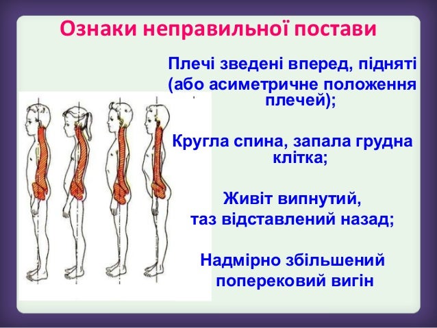 Постава