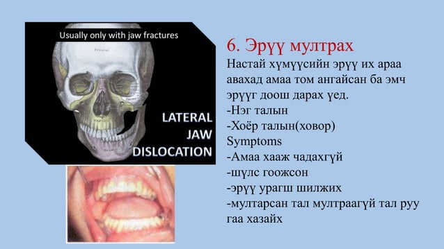 Шүд авах