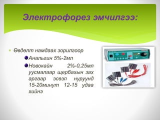Нурууны өвдөлтийн физик эмчилгээ | PPT