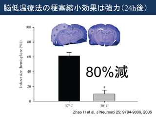 80%減
Zhao H et al. J Neurosci 25; 9794-9806, 2005
脳低温療法の梗塞縮小効果は強力（24h後）
 