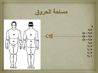 11
9
•9%
•9= %18
•9= %18
•9= %18
•9%
•9%
•9%
•9%
•1%
 