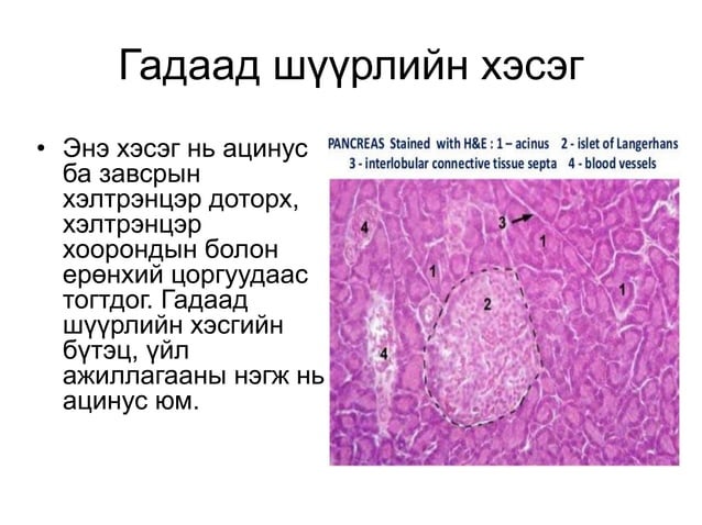 нойр булчирхайн хорт хавдар | PPT