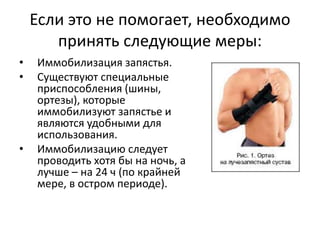 Если это не помогает, необходимо
принять следующие меры:
• Иммобилизация запястья.
• Существуют специальные
приспособления (шины,
ортезы), которые
иммобилизуют запястье и
являются удобными для
использования.
• Иммобилизацию следует
проводить хотя бы на ночь, а
лучше – на 24 ч (по крайней
мере, в остром периоде).
 