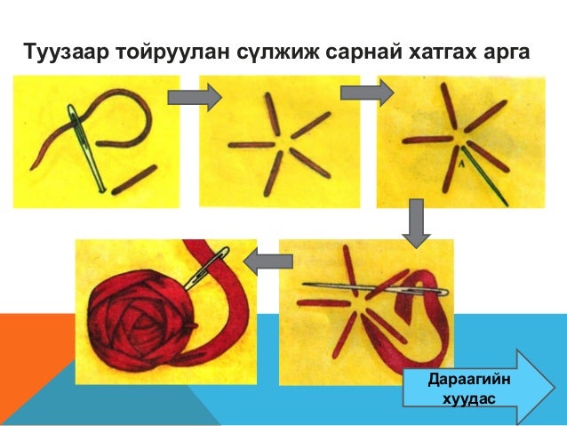 туузан хатгамал