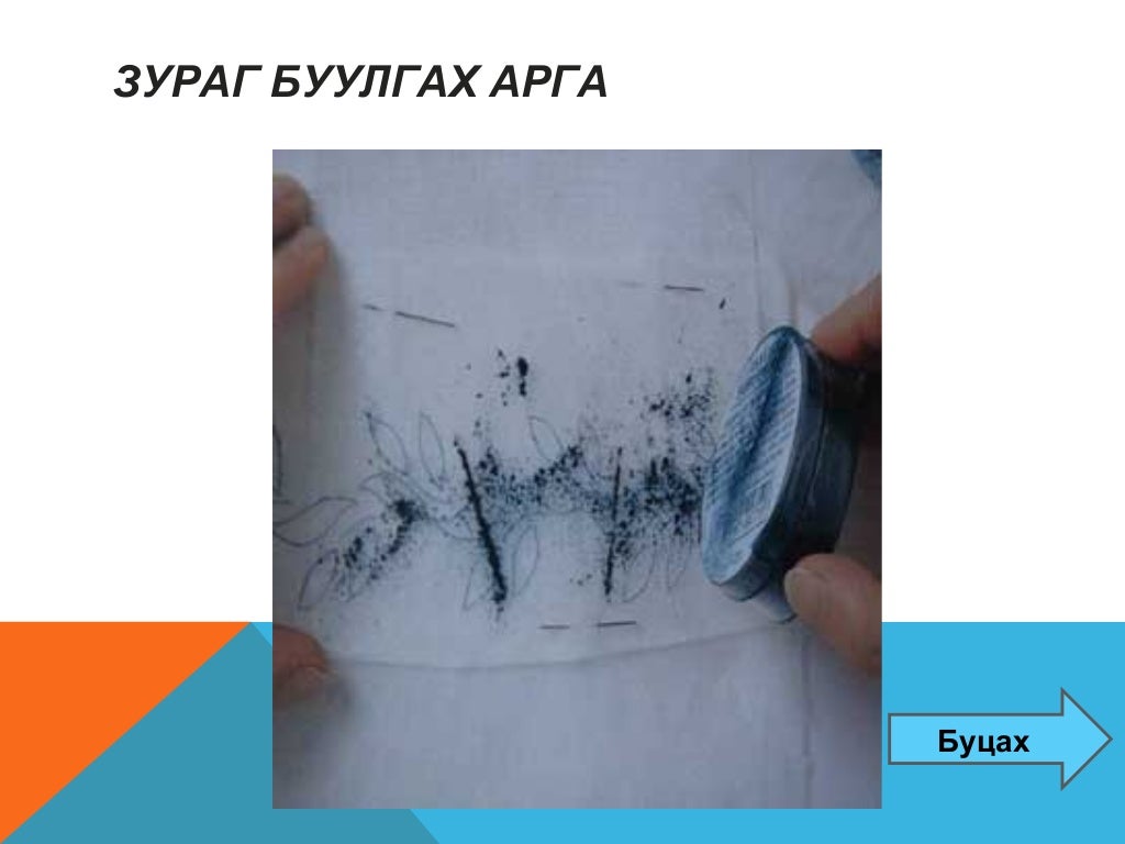 туузан хатгамал