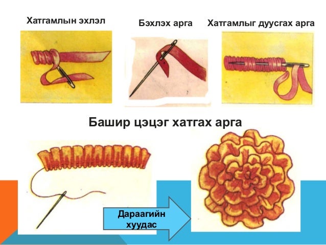 туузан хатгамал