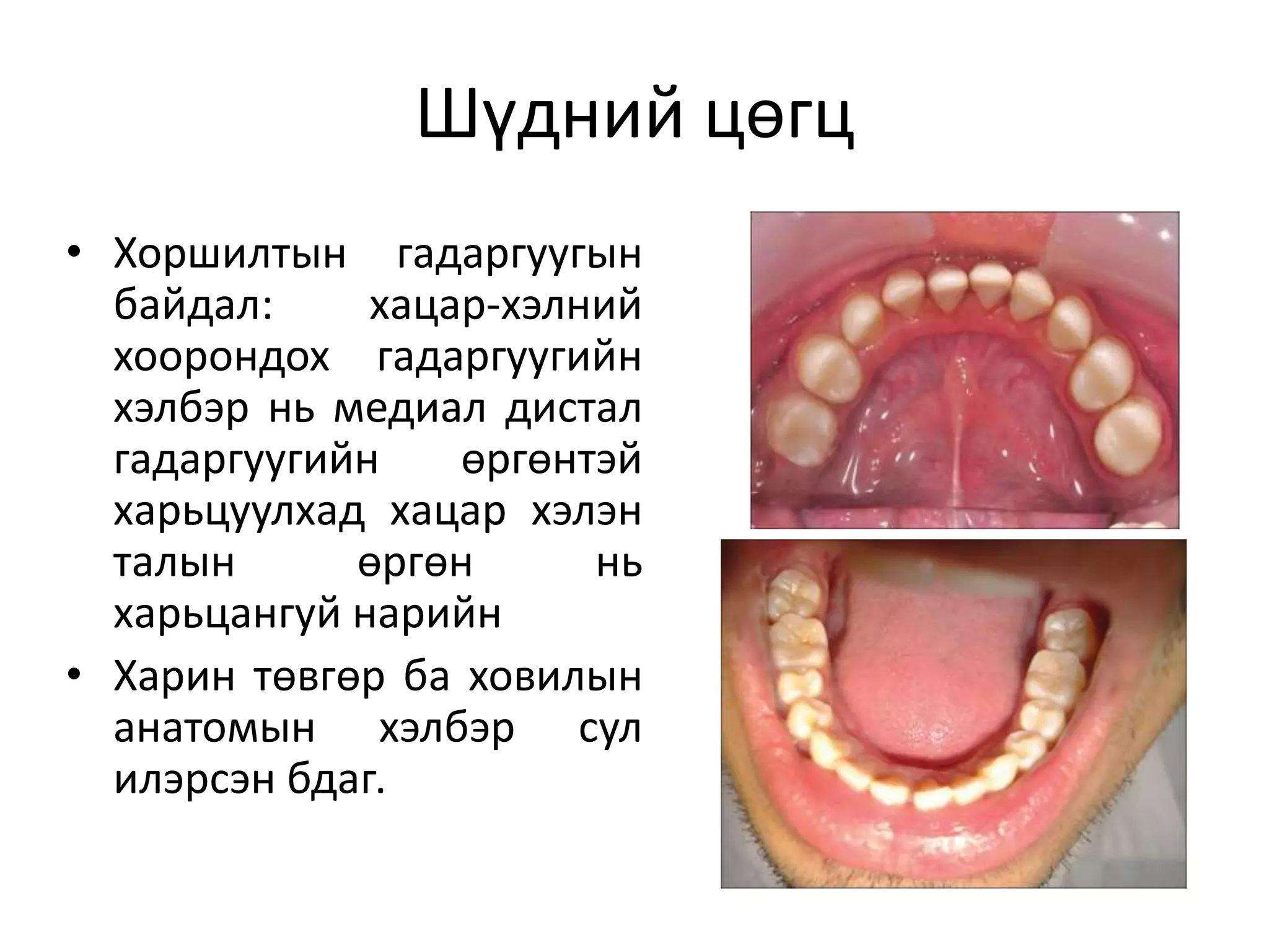 байнгын шүдний онцлог | PPT
