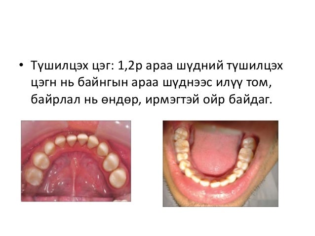 байнгын шүдний онцлог